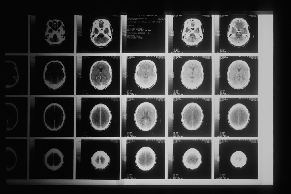 Futuristic medical AI interface with holographic brain scan overlaying human doctor's hands, sleek ambient lighting, neural network visualization, clean modern hospital setting, human-robot collaborat